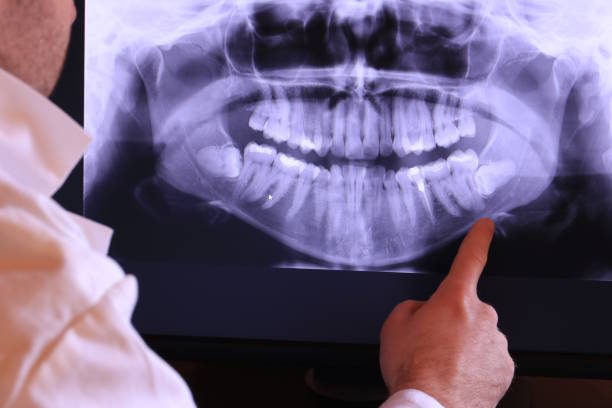 Best Urgent Tooth Repair  in Gorman, TX