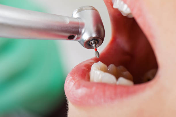 Best Dentist Open on Weekends  in Gorman, TX